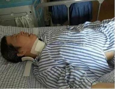 53岁大伯仰头喝可乐突然四肢瘫痪