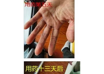 潜心探索中医奥妙创新药技服务大众----中医药文化传承者黄桃年先生记事